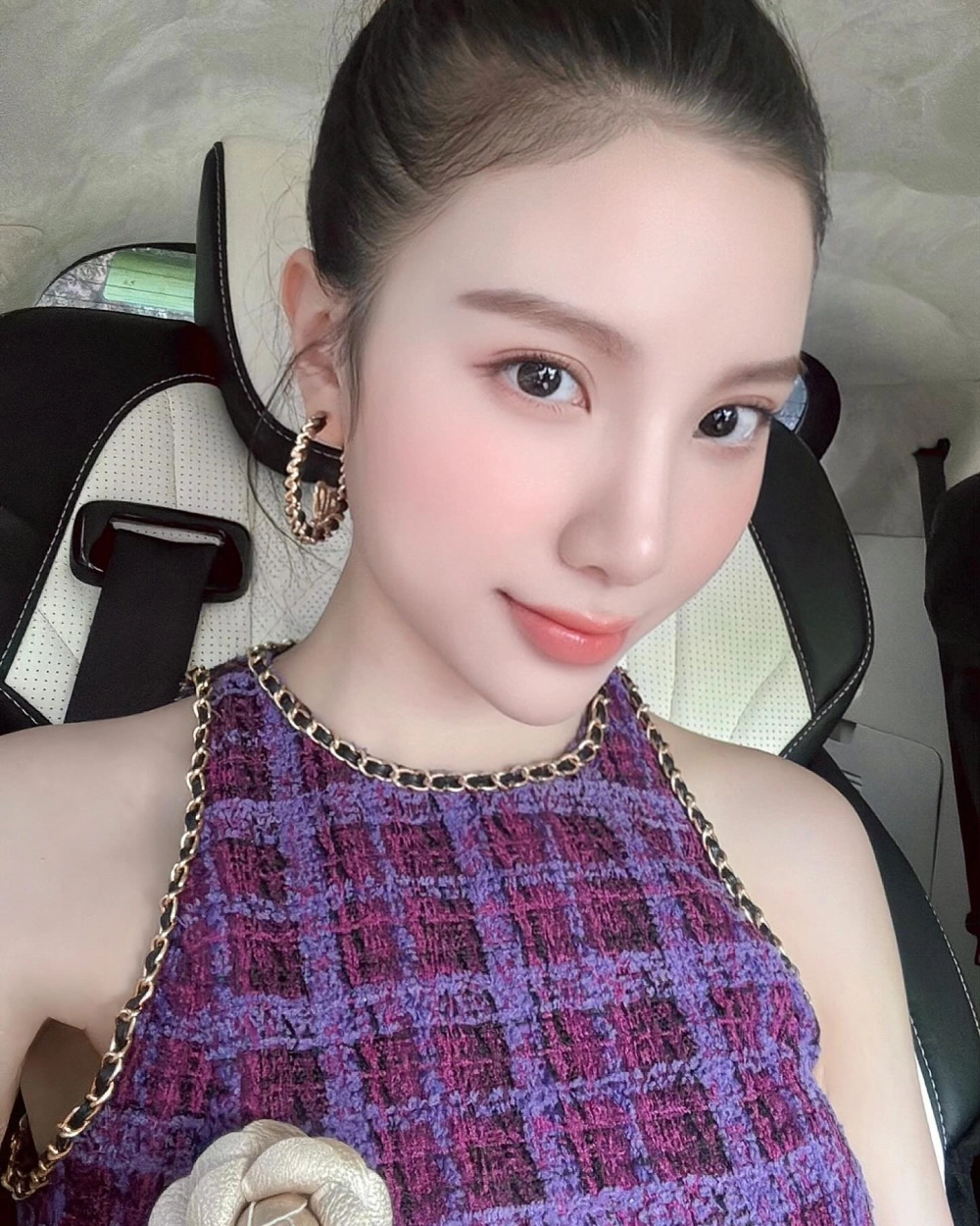 Tìm hiểu về câu chuyện hạnh sino phẫu thuật thẩm mỹ và những thay đổi đáng chú ý
